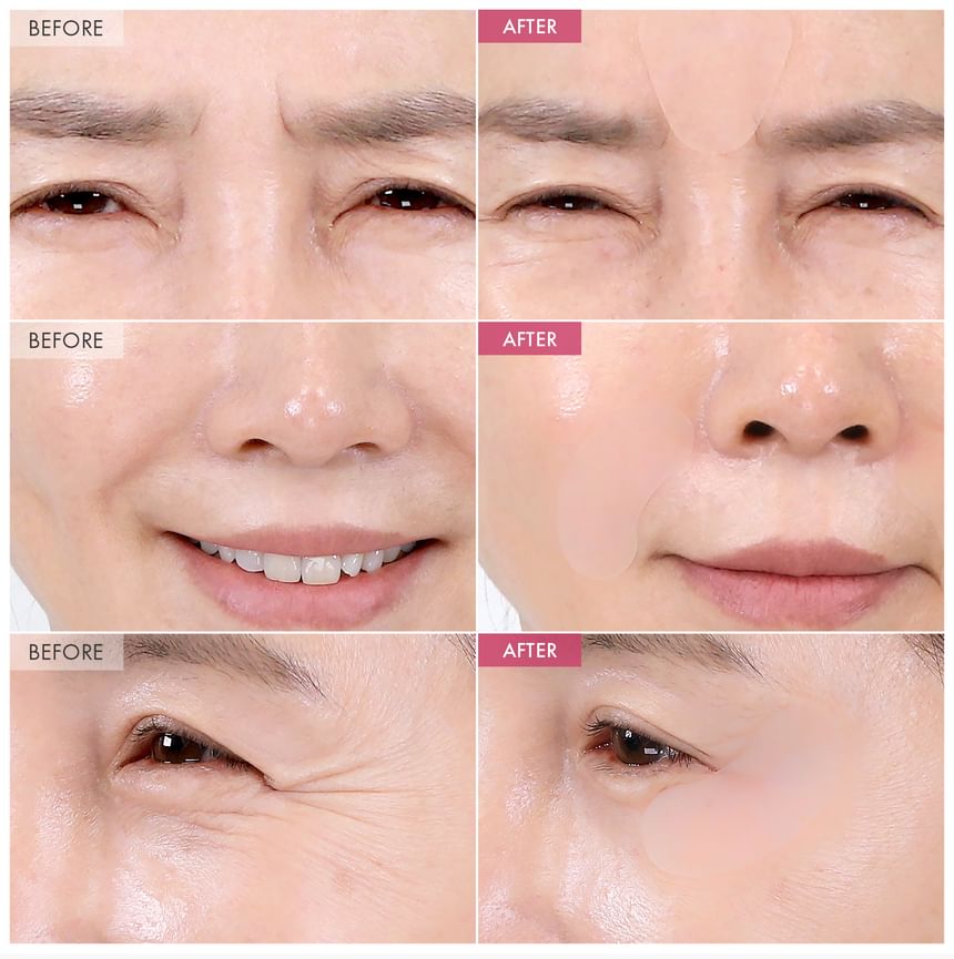 TOSOWOONG - SOS Intensive Magic Clinic Anti-rimpelpleister