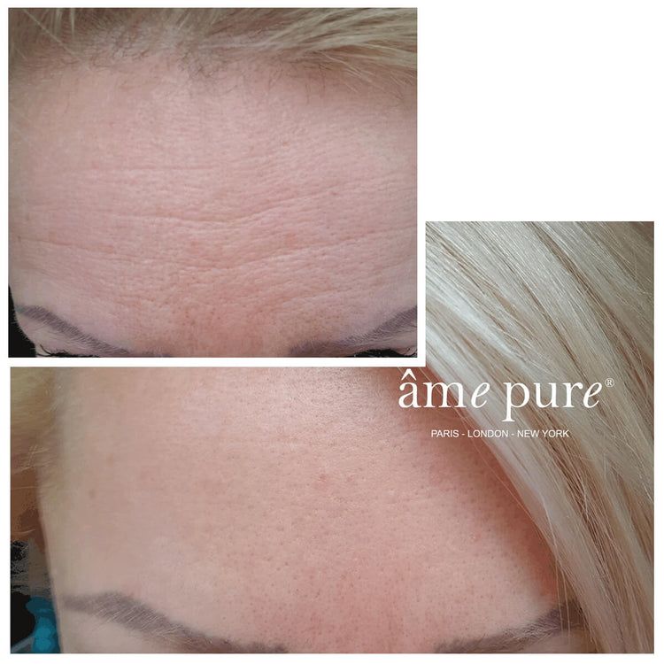 âme pure WrinklEraser BASIC
