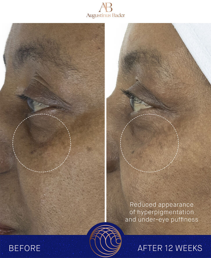Augustinus Bader The Eye Cream Nomad