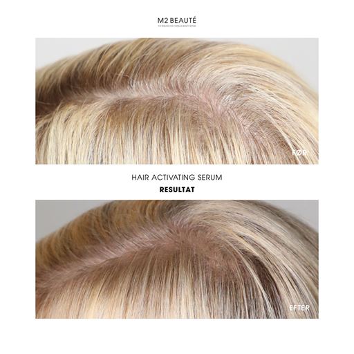 M2 Beauté Hair Activating Serum, 120 ml