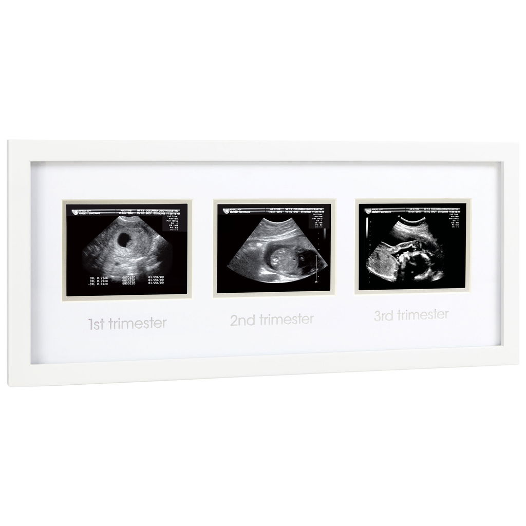 PearheadPearhead   Ultraschallbilder Rahmen