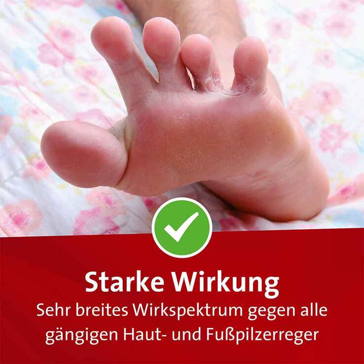 Mykosert® Spray bei Haut- und Fußpilz, 2X30 ml