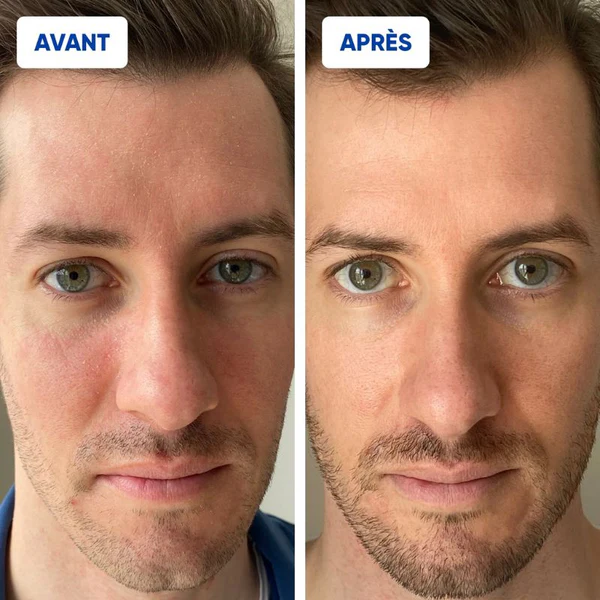 Explain Crème Hydratante Riche Céramides 50 mL
