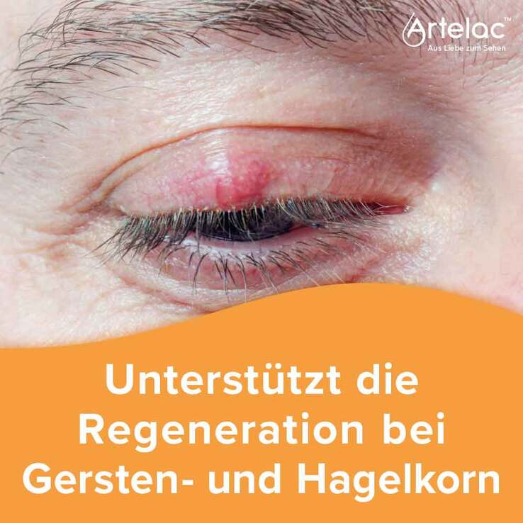 Artelac Augenlidhelfer Salbe, 15 g