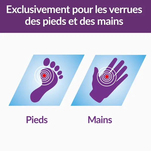 Excilor Gel Ácido para Tratamento de Verrugas nas Mãos e nos Pés 4ml