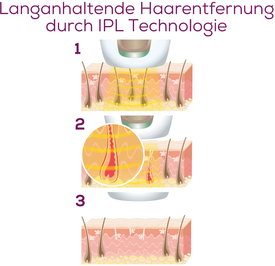 BEURER IPL-Haarentferner »IPL 5800 Pure Skin Pro« Bis zu 600.000 Lichtimpulse Klinisch getestete Technolgie für höchste Sicherheit zuhause