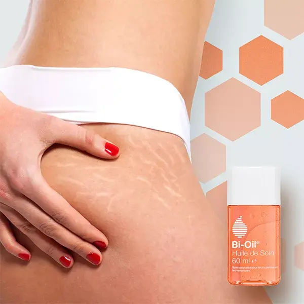 Óleo de tratamento hidratante Bi-Oil para estrias e cicatrizes 60ml