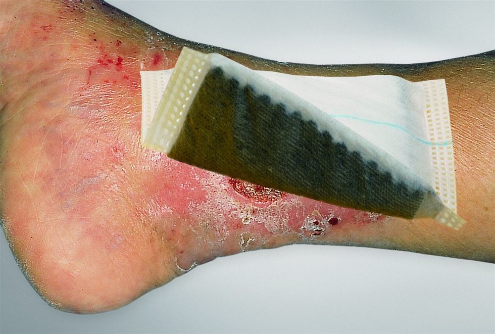 VLIWAKTIV Ag Aktivkohle Verband 10x20cm steril 10 Stk