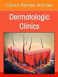 Nail Disorders: Diagnosis and Management, An Issue of Dermatologic Clinics