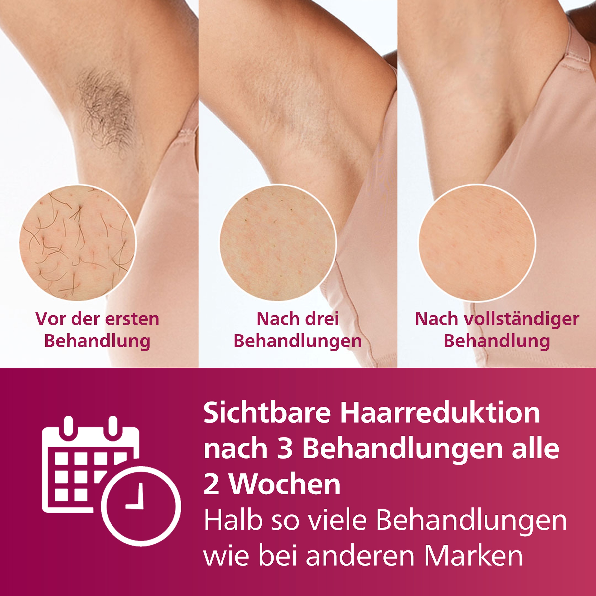 Philips IPL-Haarentferner »Lumea S7000 BRI921/00« 250.000 Lichtimpulse 2 Aufsätze (Körper und Gesicht), inkl. Präzisionstrimmer