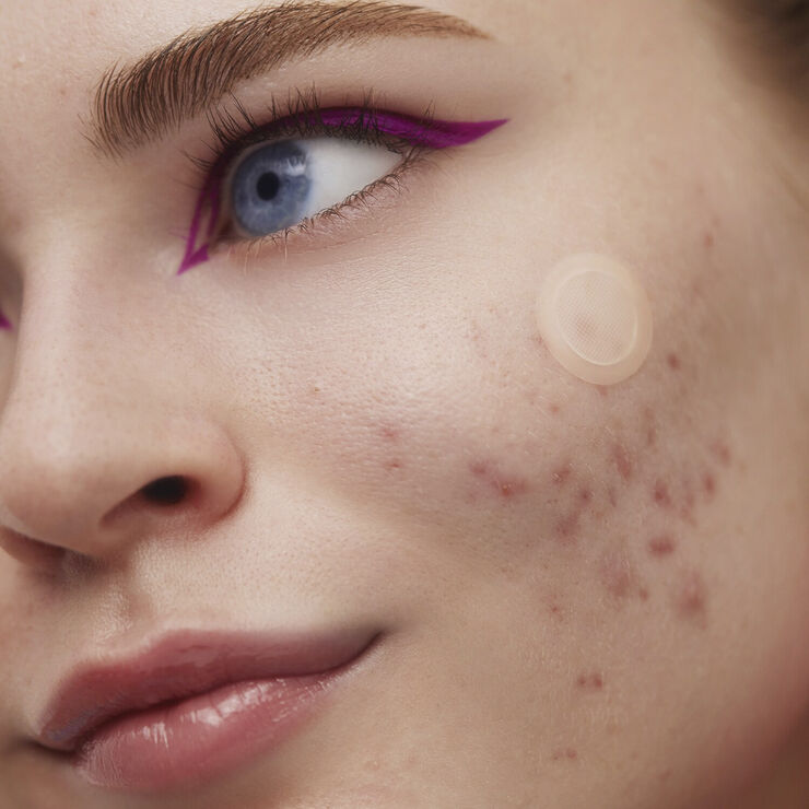 Sephora Collection ACNE EARLY STAGE ACNE DOT 0. 74G