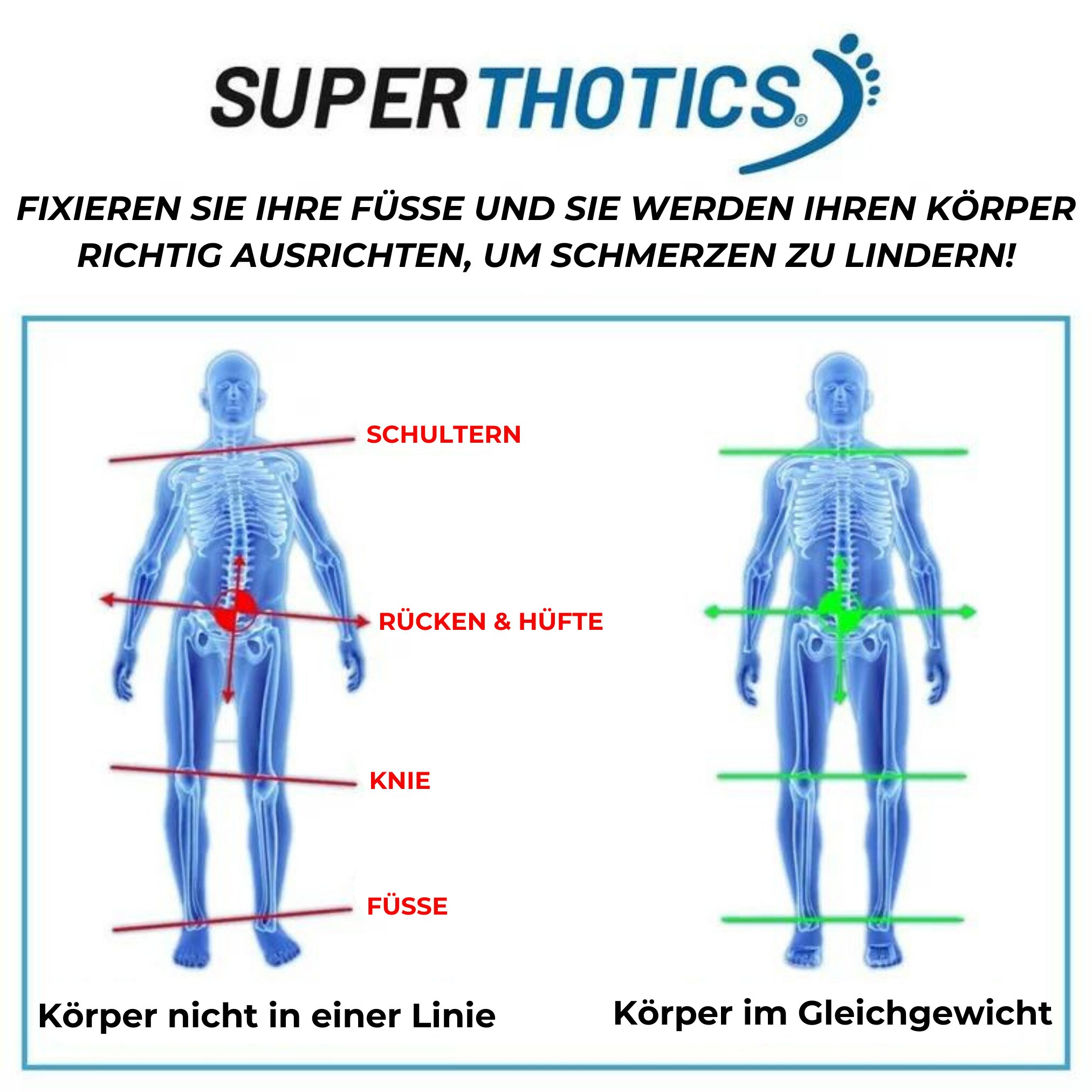 Superthotics® Einlegesohlen orthopädisch - Schuheinlagen Superthotics