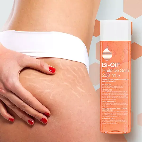 Bi-Oil Huile de Soin Hydratante Vergetures et Cicatrices 200ml