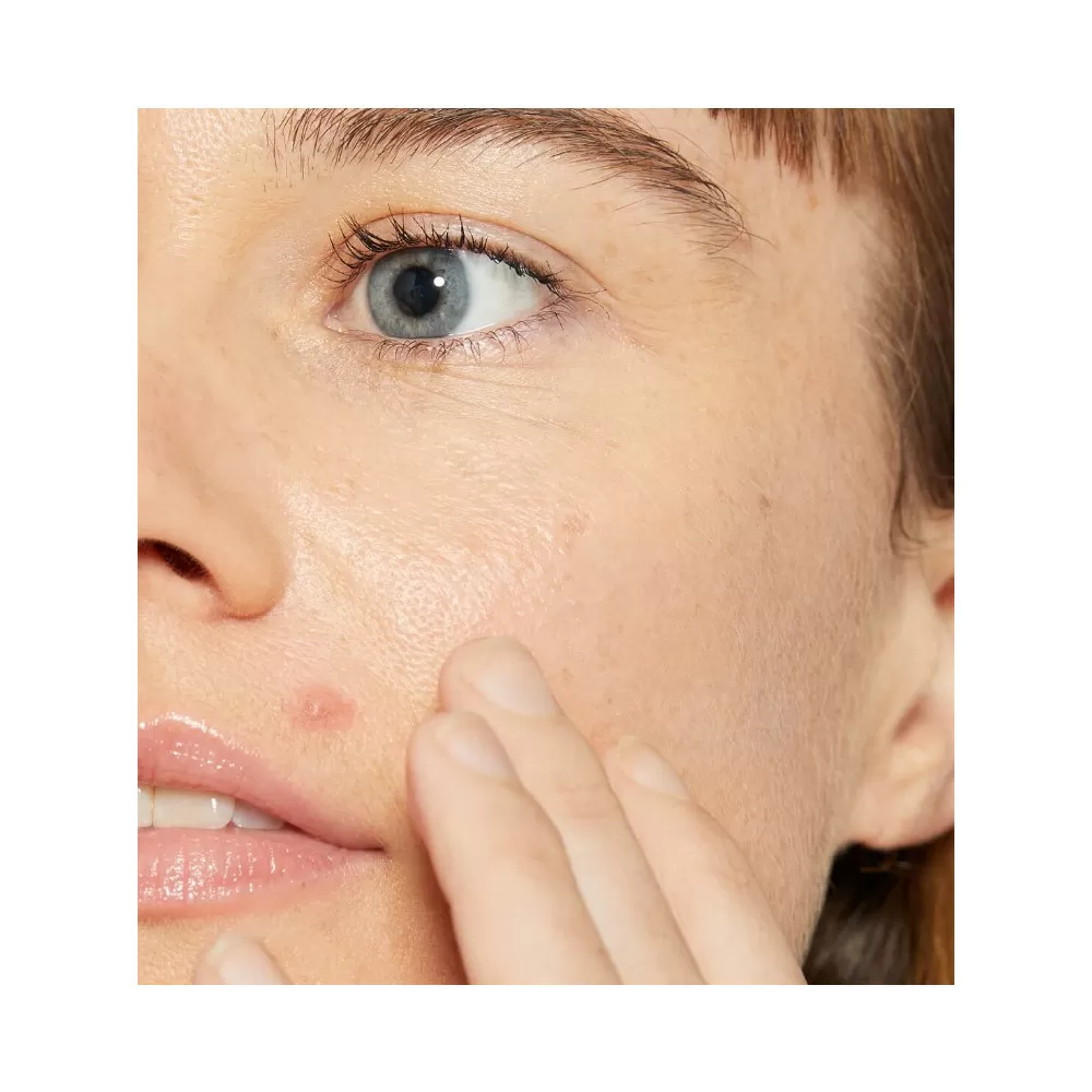 Dermalogica Deep Breakout Liquid Patch - 15 ml.