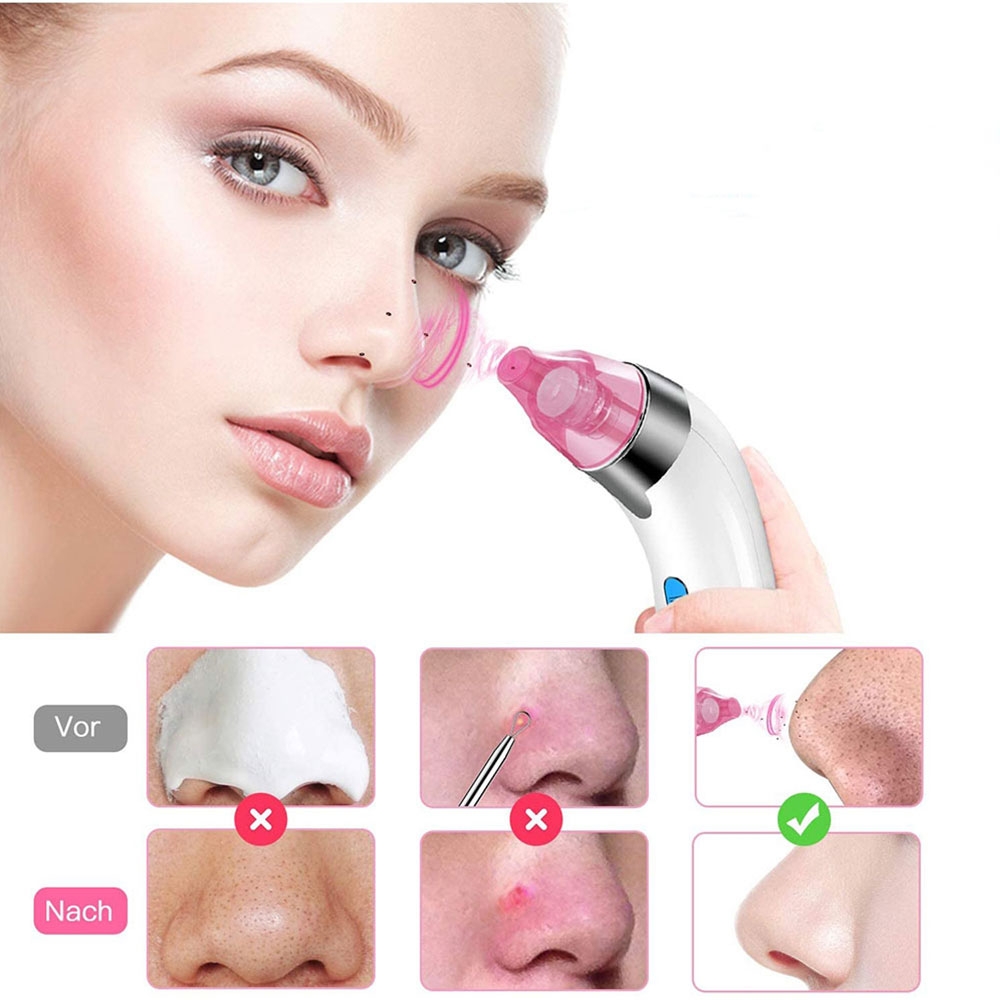 (5-tlg. Set) Elektrischer USB Gesichtsreiniger / Pflegepeeler / Mitesserentferner - Weiss / Rosa