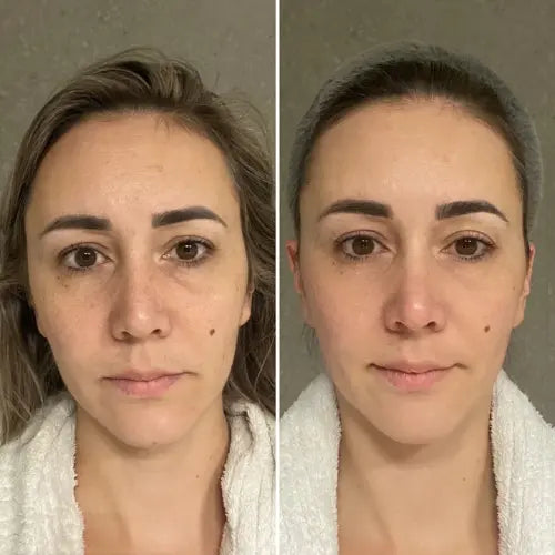 Hydrolyzed Collagen & Vitamin C