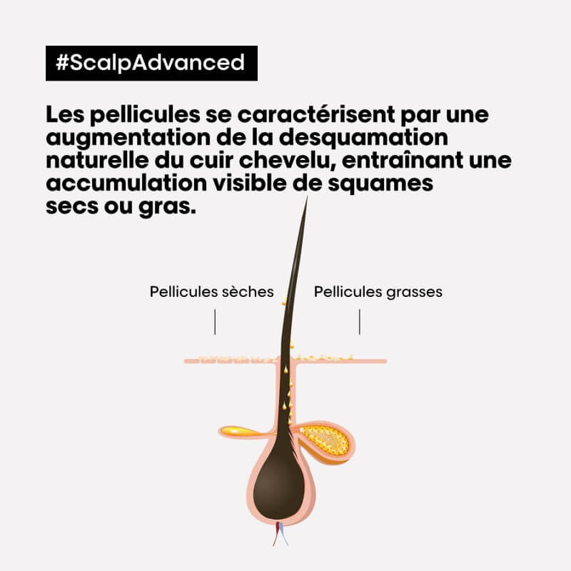 Shampooing clarifiant antipelliculaire Scalp Advanced L'Oréal Professionnel 500ML
