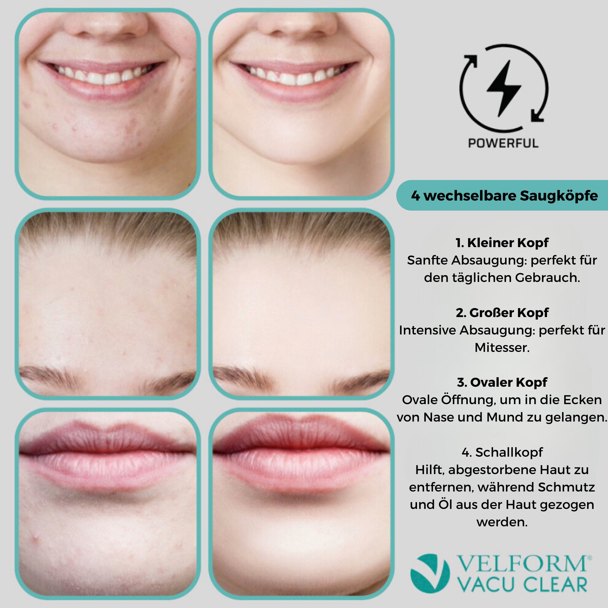 Velform® Mitesserentferner - Porenreiniger Gesicht - Porensauger Vacu Clear