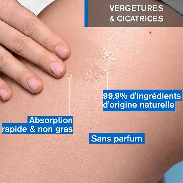 Uriage Bariéderm-Cica Óleo Reparador Dermatológico para Estrias 100ml