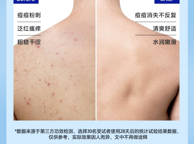 Z:SEA - Water Fruitzuur Acne Verwijderende Douchegel
