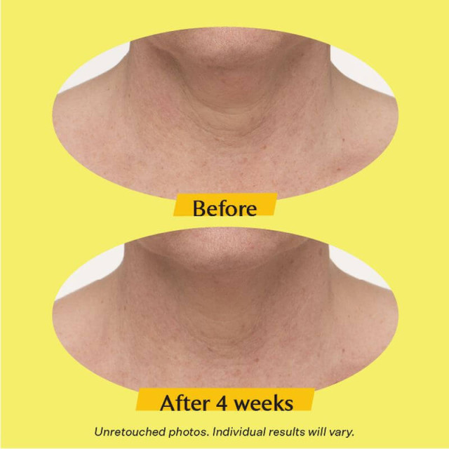 TL Advanced Crème raffermissante pour le cou STRIVECTIN