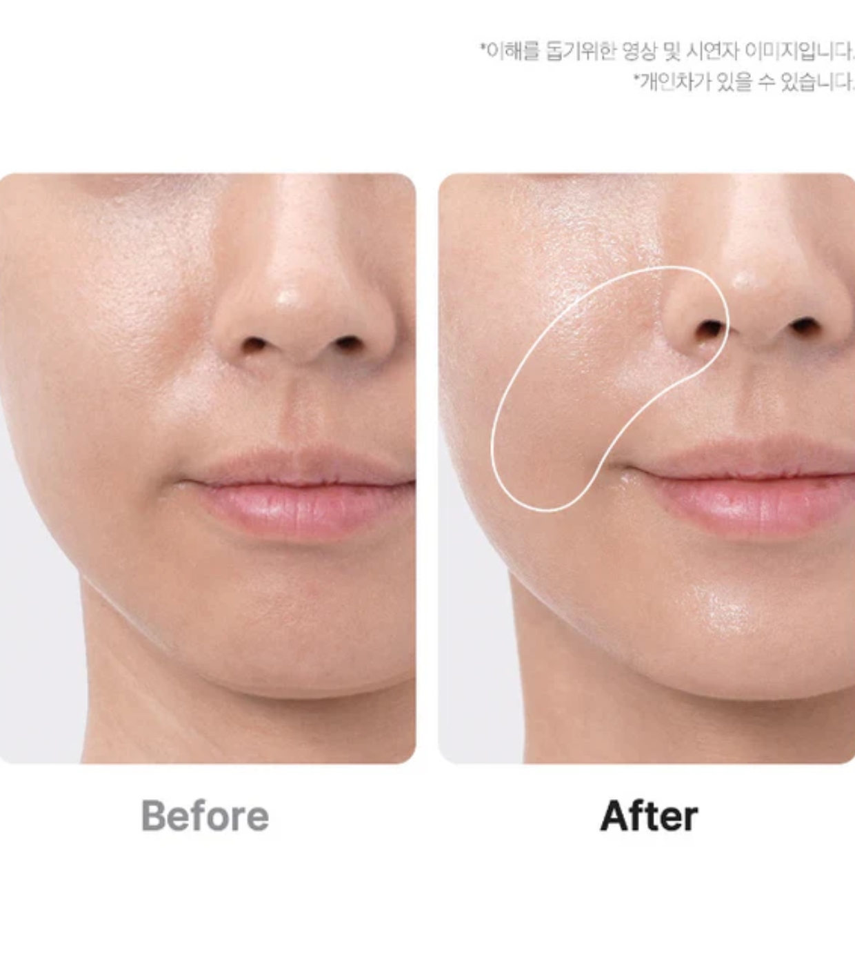 Medicube - *Age-R* - Dispositivo Avançado para Cuidados Faciais Booster Pro - Preto