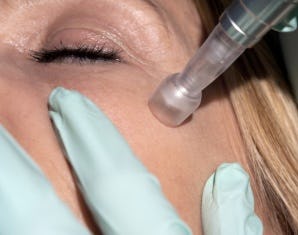 Hautverjüngung durch Mesotherapie in Basel als Geschenkidee