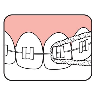 TePe Bridge & Implant Floss 30ST