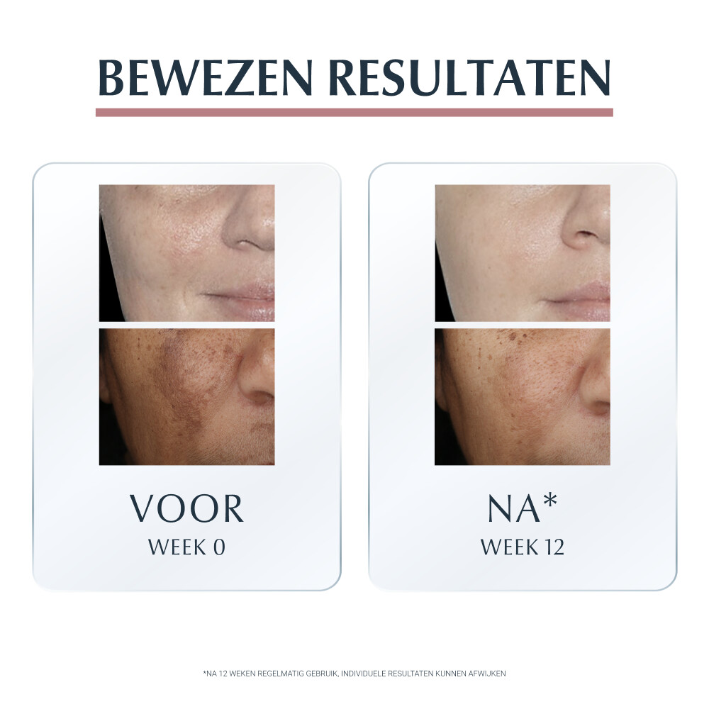 Eucerin Anti-Pigment Serum Duo30 ml