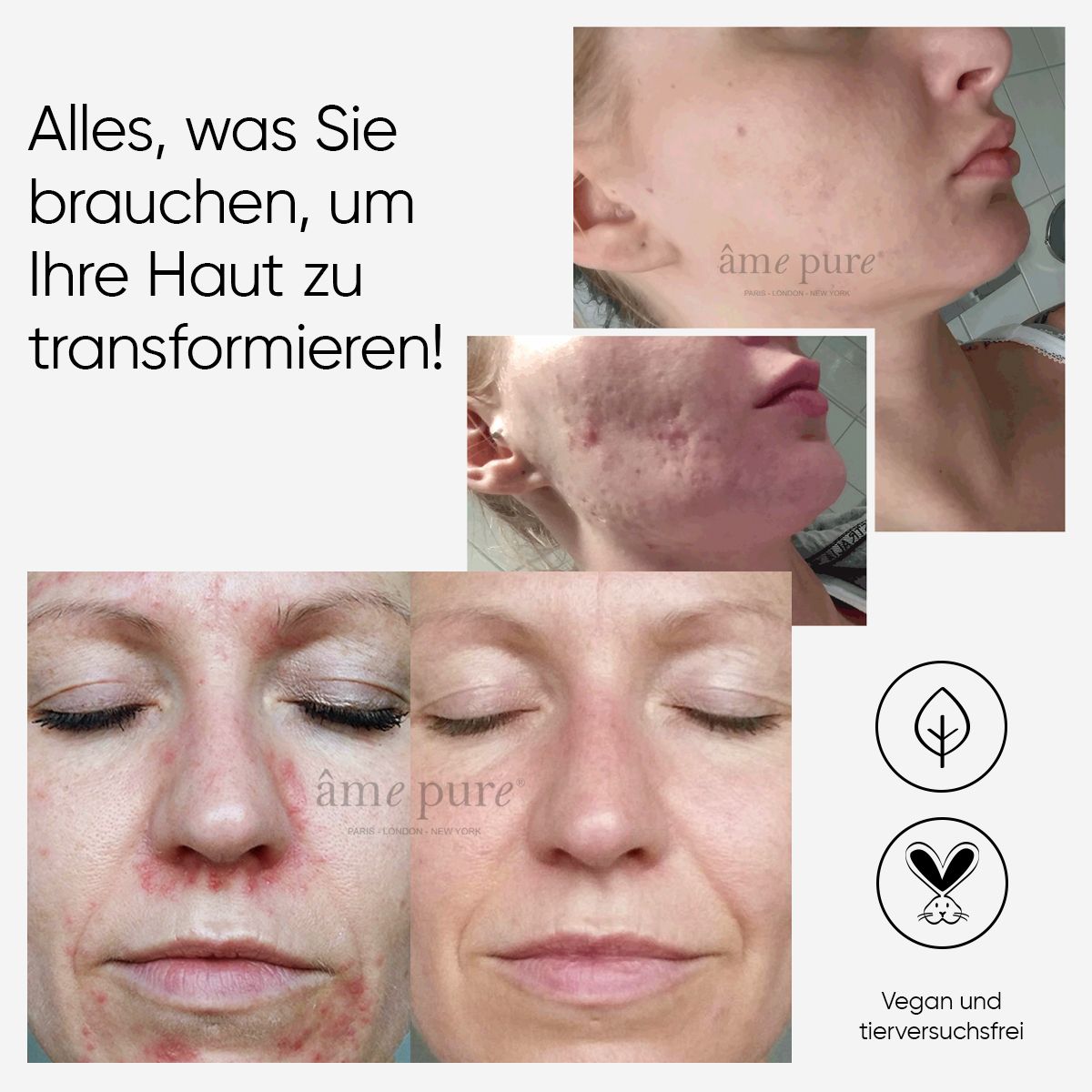 âme pure CIT Face Roller PLATINUM