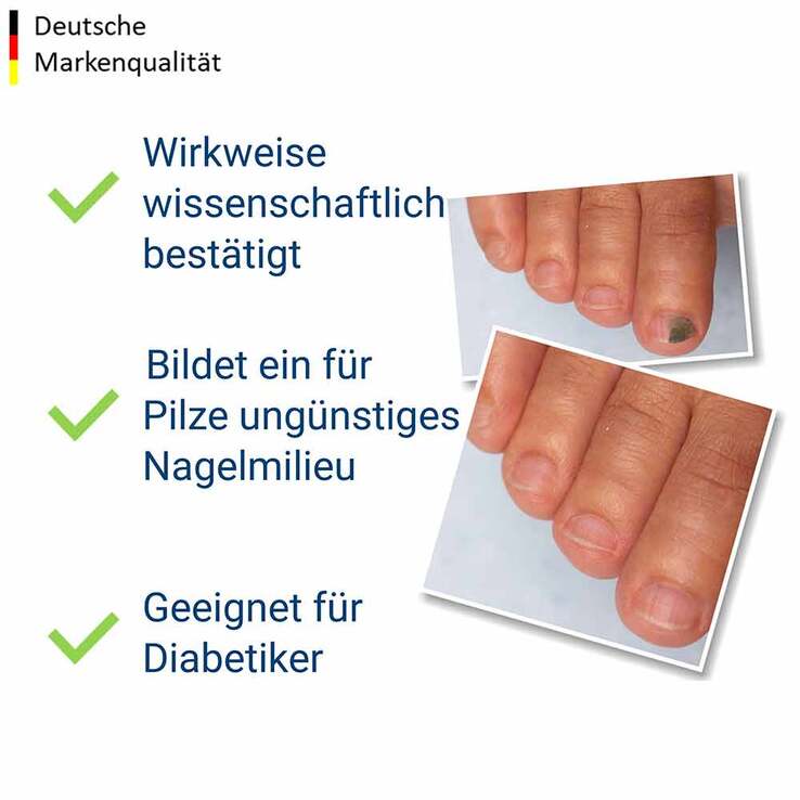 Evolsin Anti-Nagelpilz liquid, 10 ml