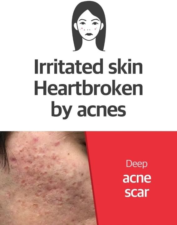 SOME BY MI - Snail Truecica Miracle Repair Toner