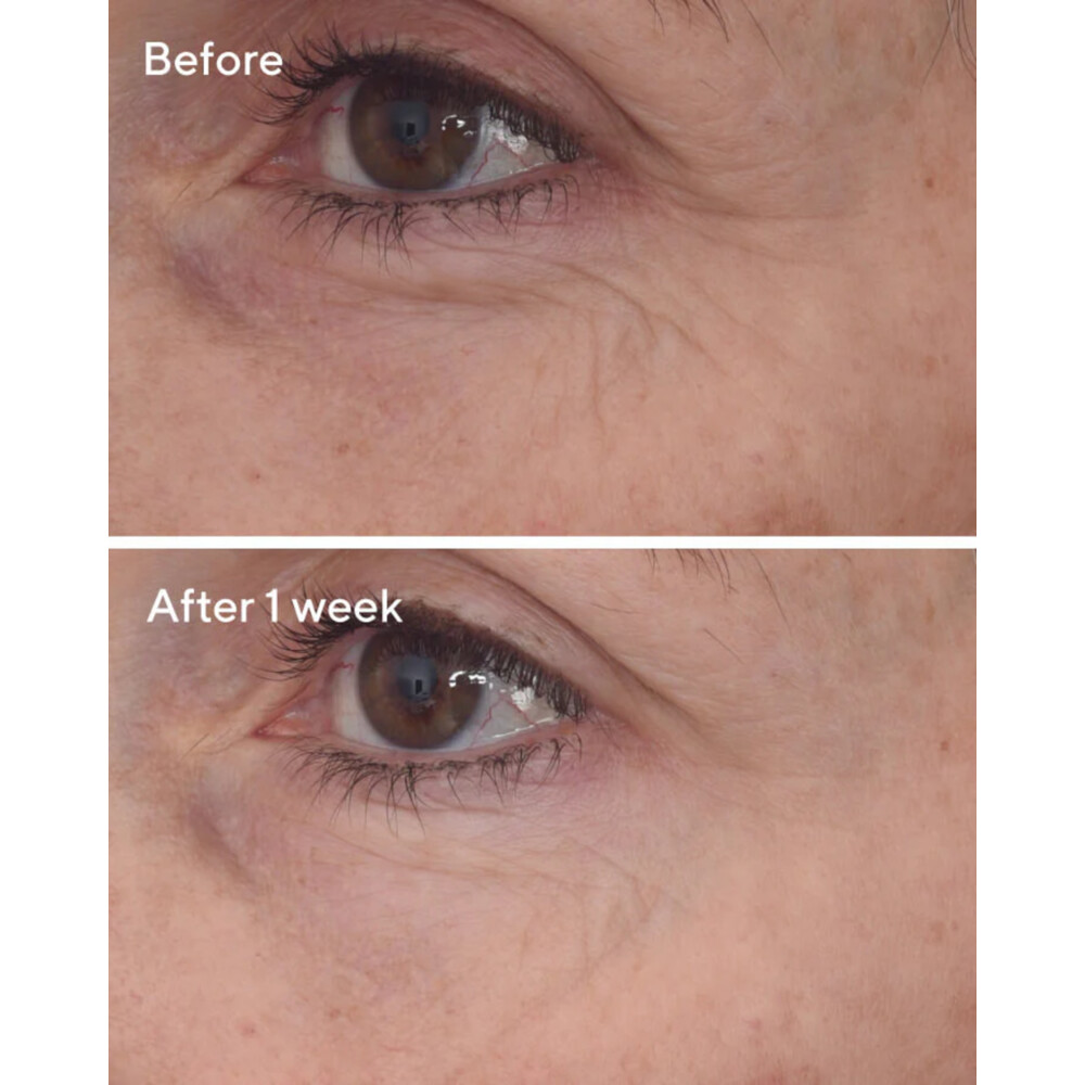 Murad Skincare Retinal Resculpt Eye Lift Treatment15 ml