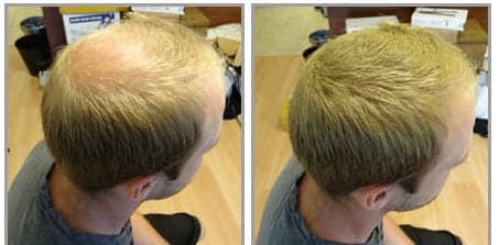 TEST HÅRFIBER - JASON BY SWEDEN - 4G -  LYSEBLOND - LIGHT BLONDE