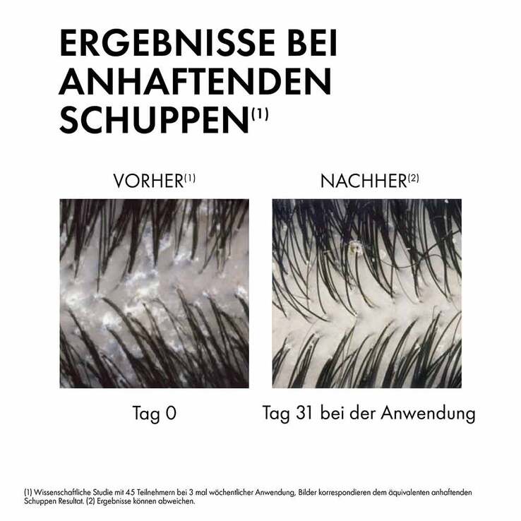 Vichy Dercos Anti-Schuppen Shampoo trockene Kopfhaut, 390 ml
