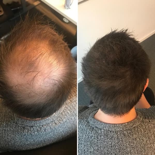 Jason By Sweden Refill Hårfibrer 30g - Mørkebrun