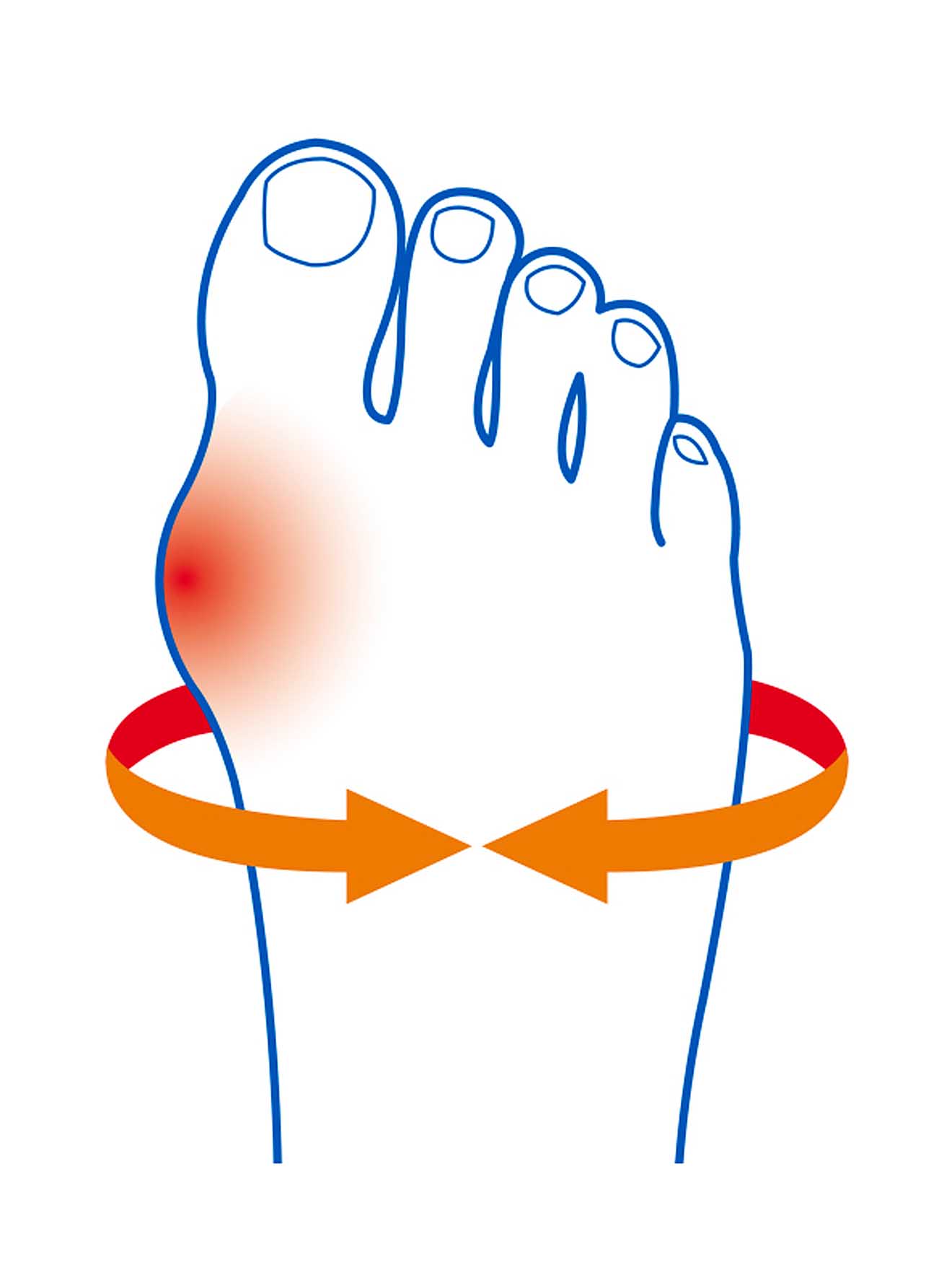 Protection hallux valgus Epithélium 26®
