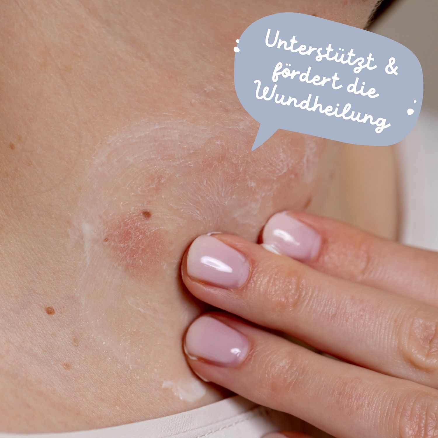 das boep med Wundcreme