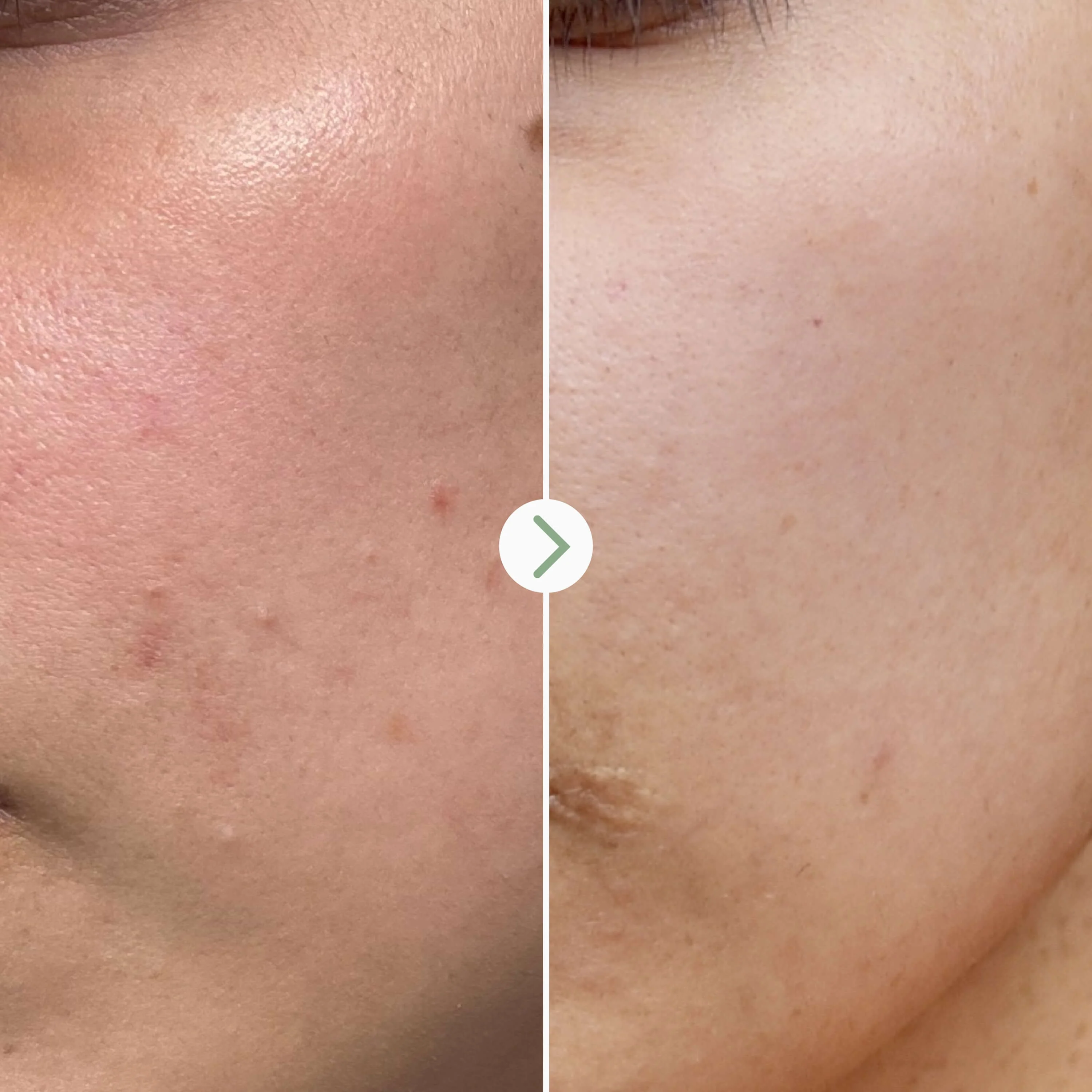 Pai Skincare Booster Tri-Mushroom 10% Apaisant