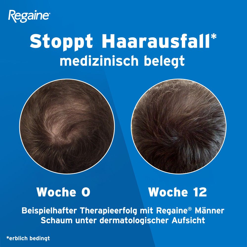 Regaine® Männer Lösung mit 5% Minoxidil