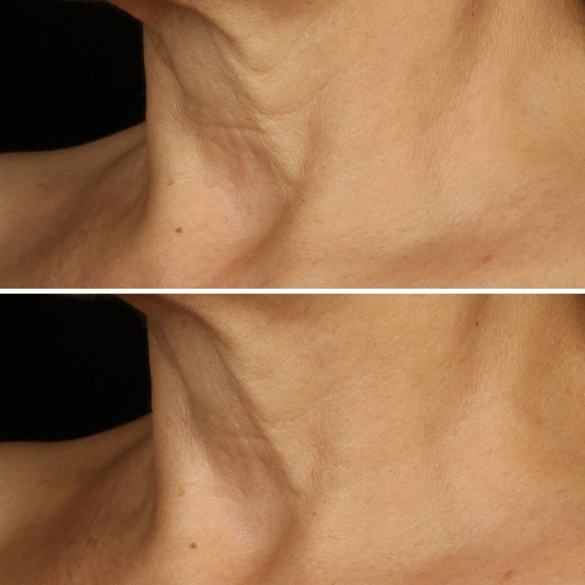 CLINIQUE Smart Clinical Repair™Crème Liftante Visage + Cou