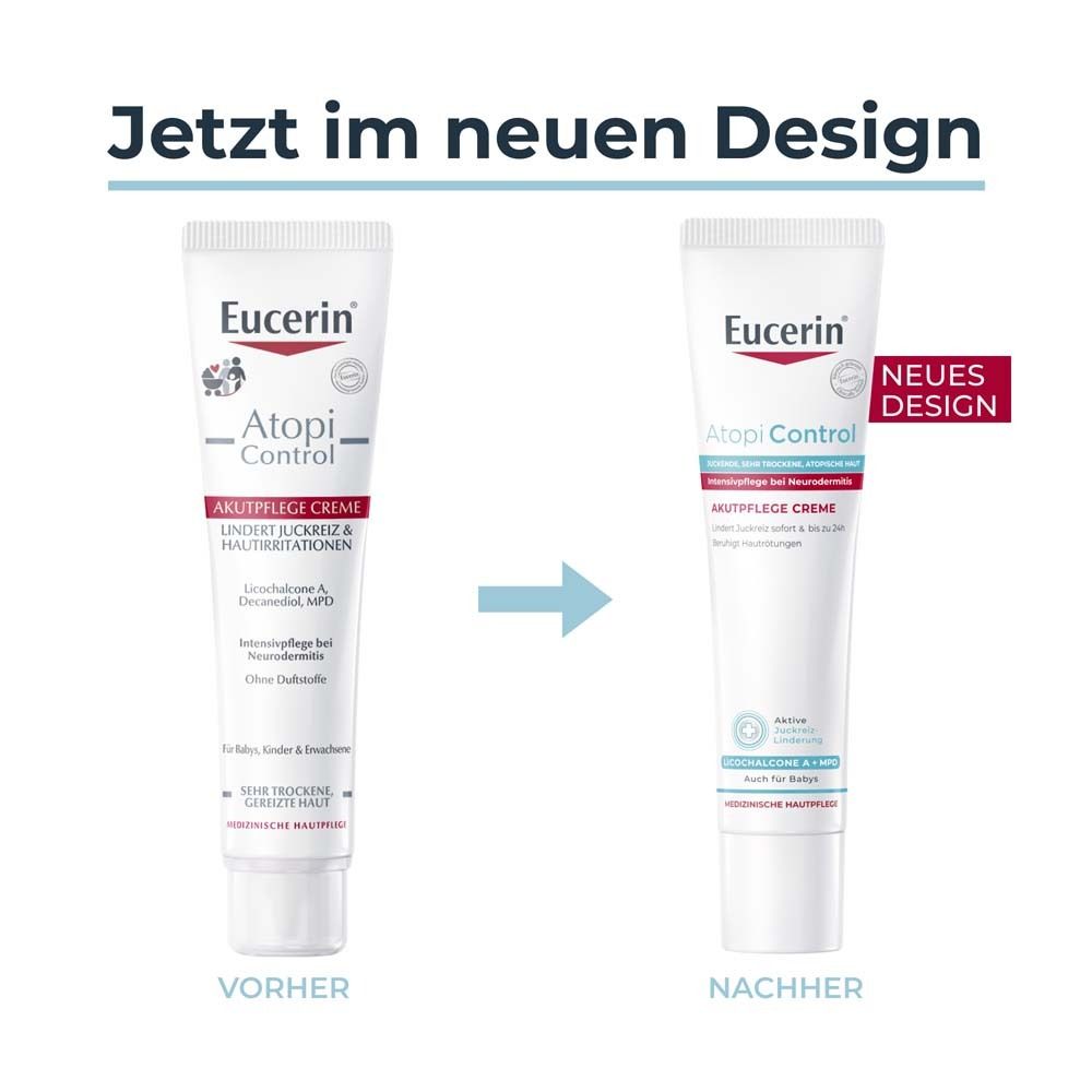 Eucerin® AtopiControl Akutpflege Creme reduziert Juckreiz und lindert Rötungen bei akuten Neurodermitisschüben. - Jetzt 3€ sparen mit Code 
