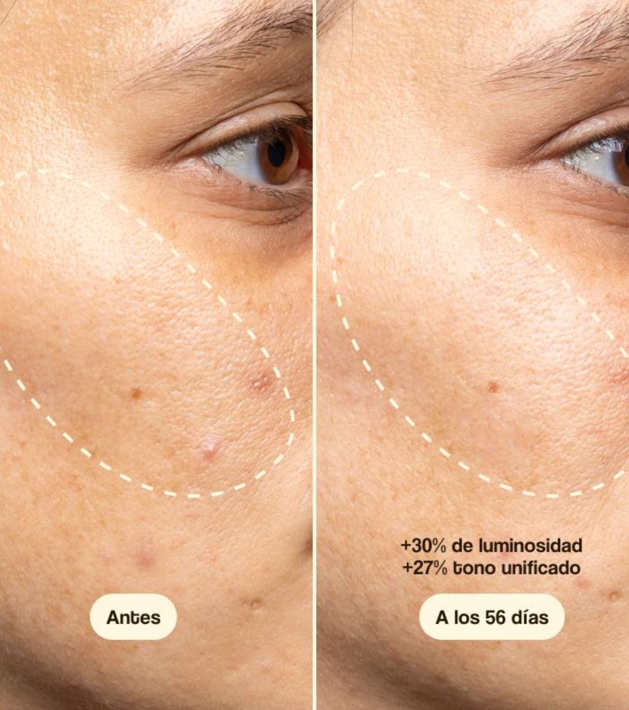 Freshly Cosmetics - Tratamento Facial com Vitamina C