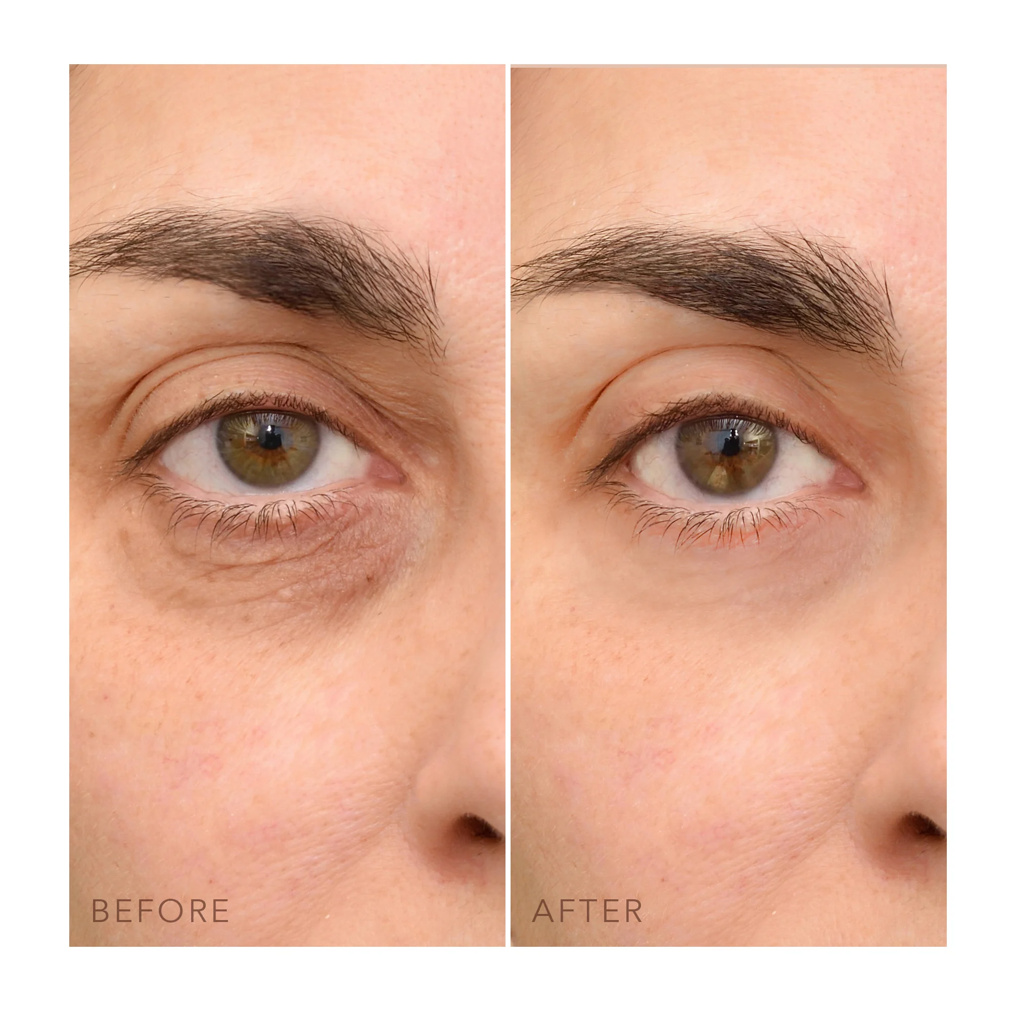 IRIS(TM) C-Concentrated Eye Cream |