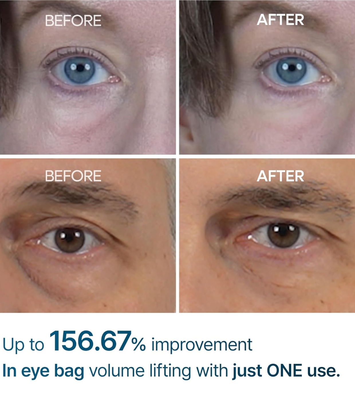 Dr.Melaxin - Creme para Olheiras Eyephalt