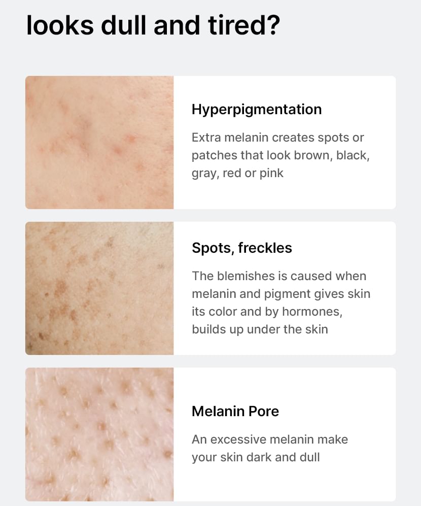 celimax - Porie + Donkere Vlekken Verhelderend Serum Mini