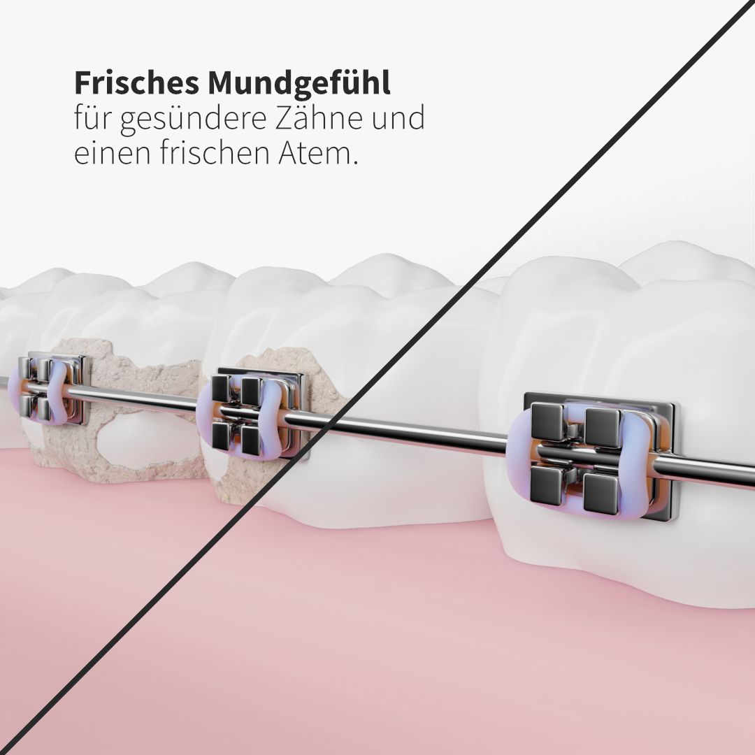 Zahnheld Ersatzdüsen Deep Care schwarz (6Stück)