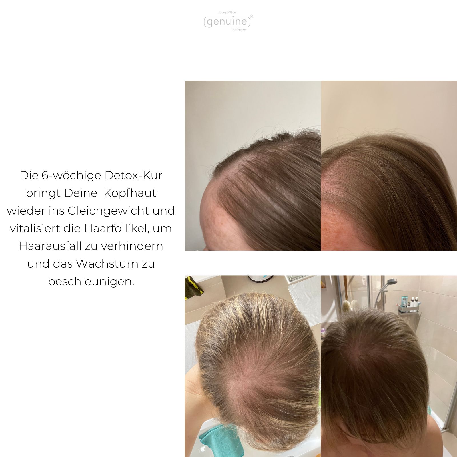 genuine haircare -  Balance Scalp Lotion