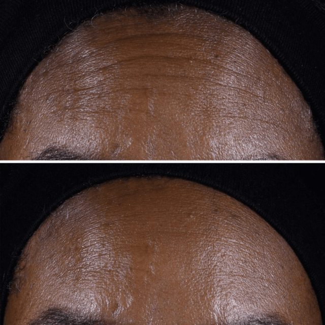 Smart Clinical Repair Crème Liftante Visage et Cou CLINIQUE