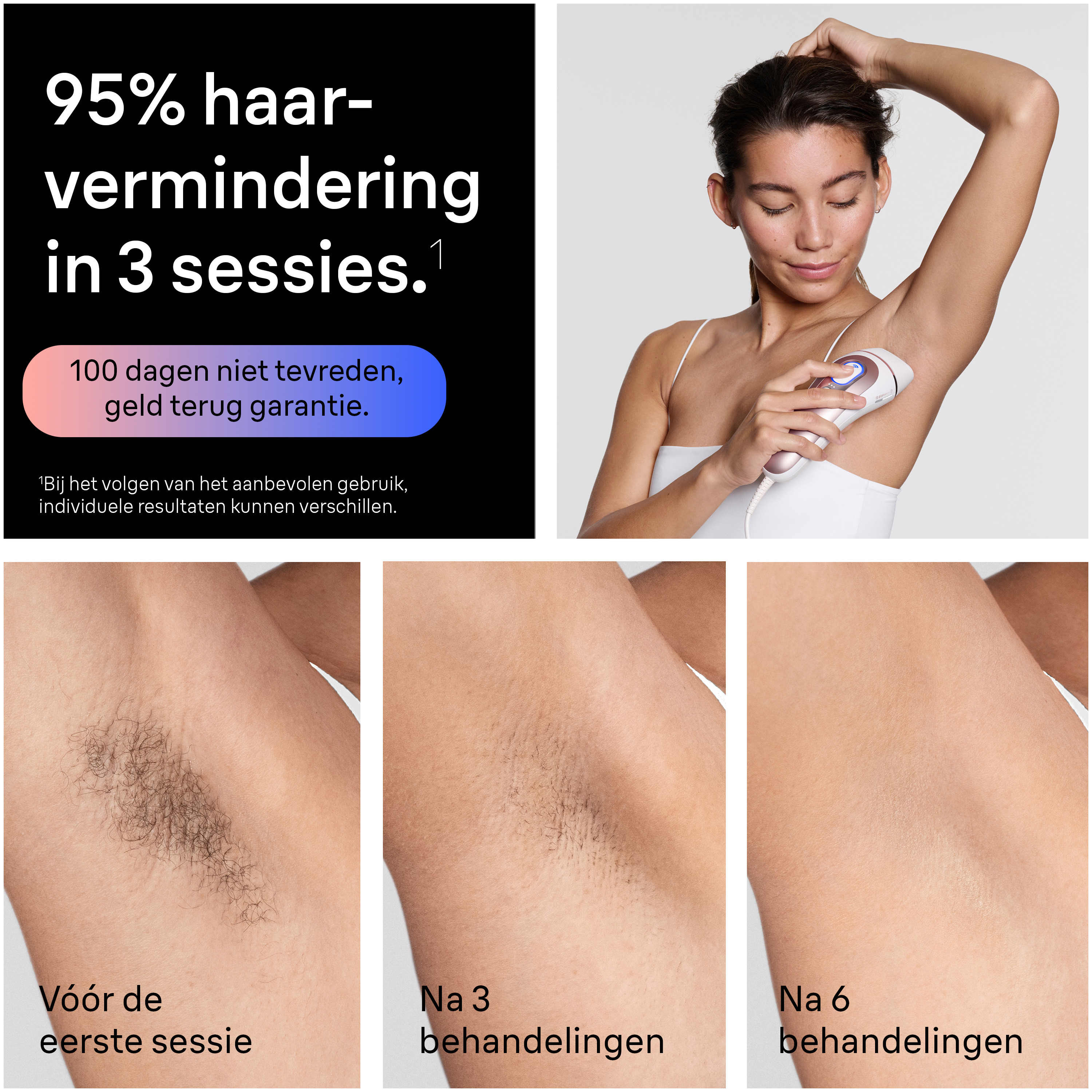 Braun IPL Skin i·expert PL7211